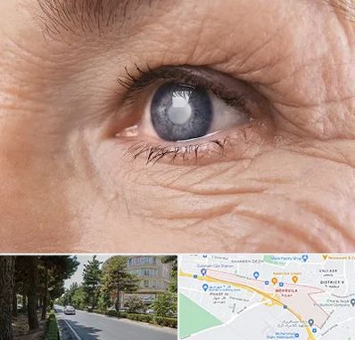 متخصص آب مروارید در مهرویلا کرج