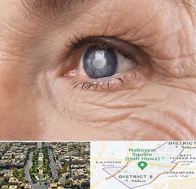 متخصص آب مروارید در نارمک