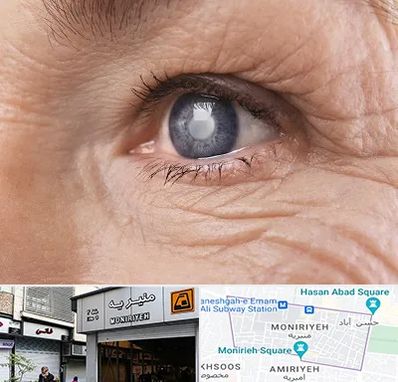 متخصص آب مروارید در منیریه