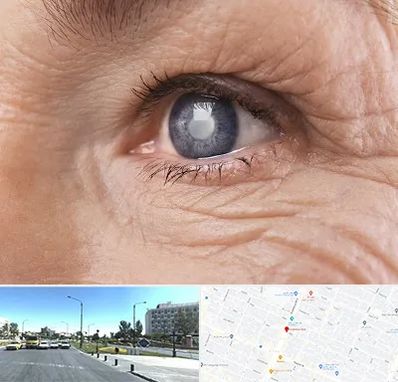 متخصص آب مروارید در بلوار کلاهدوز مشهد