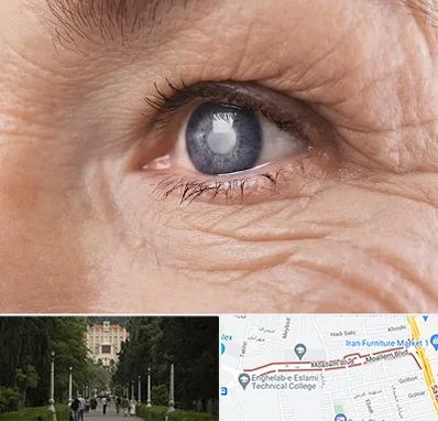 متخصص آب مروارید در بلوار معلم رشت