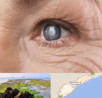 متخصص آب مروارید در بندرلنگه