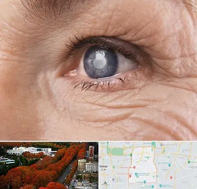 متخصص آب مروارید در منطقه 6 تهران