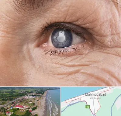 متخصص آب مروارید در محمودآباد