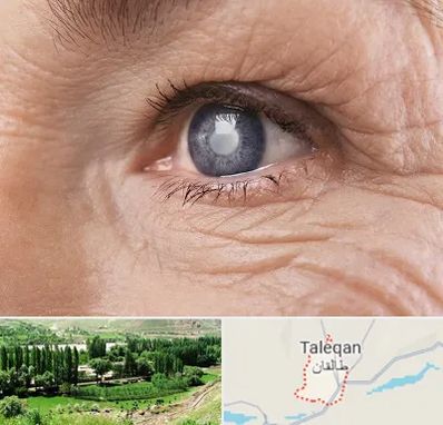 متخصص آب مروارید در طالقان