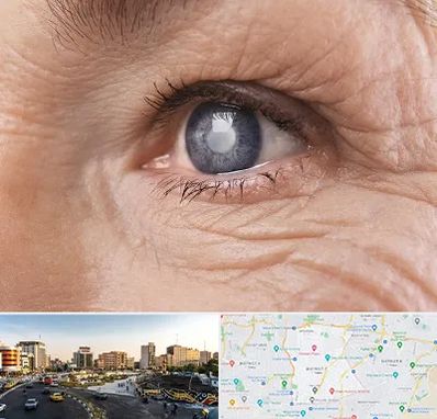 متخصص آب مروارید در منطقه 7 تهران