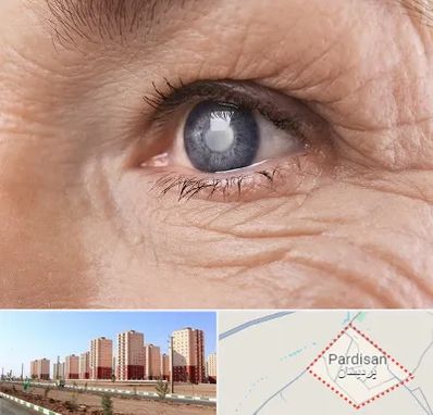 متخصص آب مروارید در پردیسان قم