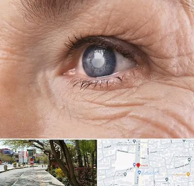 متخصص آب مروارید در خیابان توحید اصفهان