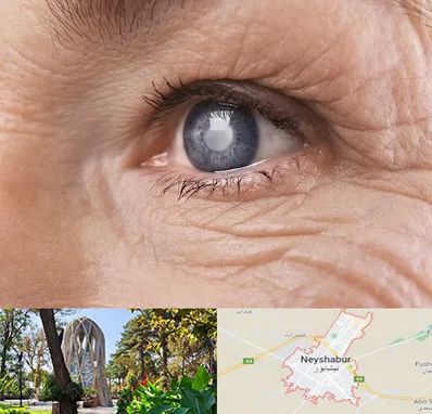 متخصص آب مروارید در نیشابور