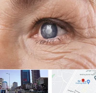 متخصص آب مروارید در چهارراه طالقانی کرج