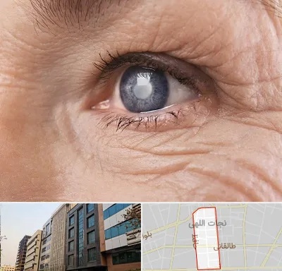 متخصص آب مروارید در نجات اللهی