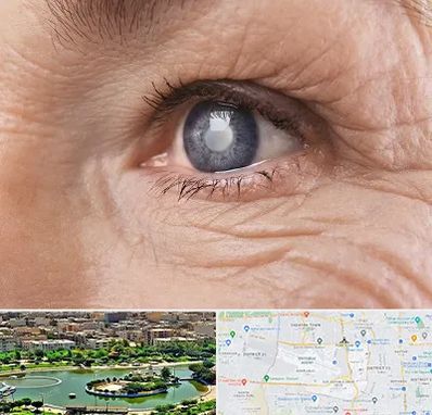 متخصص آب مروارید در منطقه 9 تهران