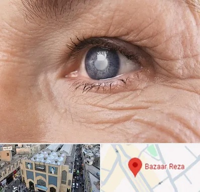 متخصص آب مروارید در بازار رضا مشهد