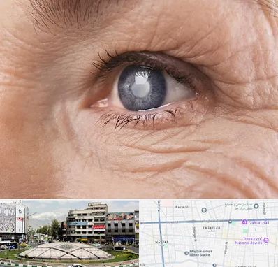 متخصص آب مروارید در مرکز تهران