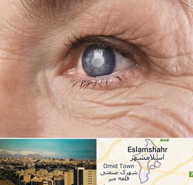 متخصص آب مروارید در اسلامشهر