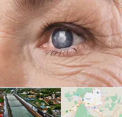 متخصص آب مروارید در مراغه