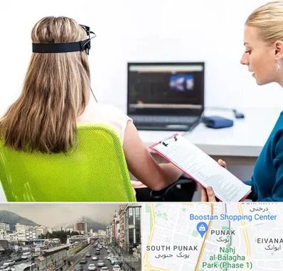 نوروفیدبک در پونک 