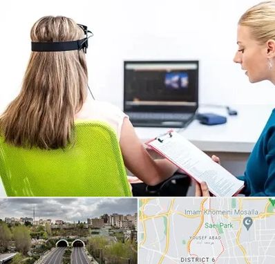 نوروفیدبک در یوسف آباد 