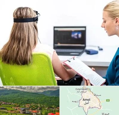 نوروفیدبک در آمل