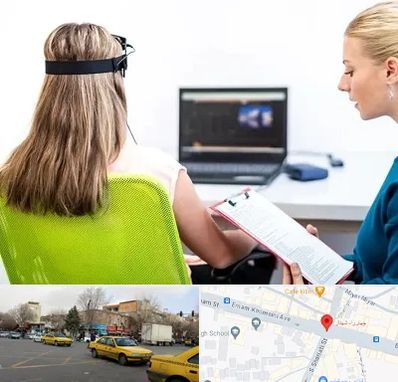 نوروفیدبک در شهناز تبریز