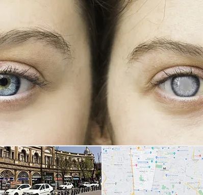 متخصص آب سیاه (گلوکوم) در منطقه 11 تهران 