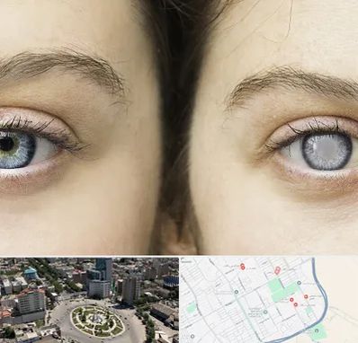 متخصص آب سیاه (گلوکوم) در زرافشان اسلامشهر