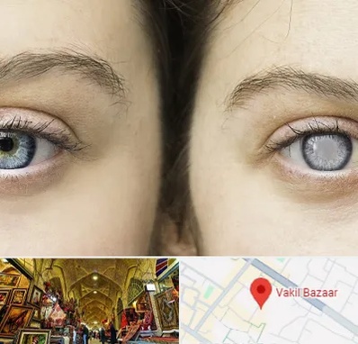 متخصص آب سیاه (گلوکوم) در بازار وکیل شیراز