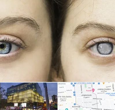 متخصص آب سیاه (گلوکوم) در جمهوری 