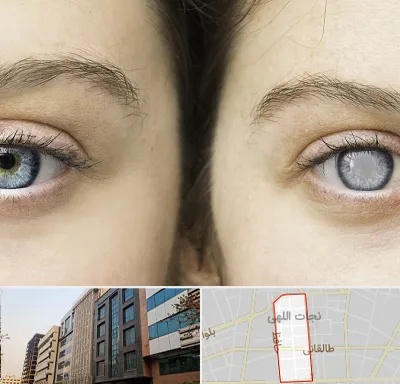 متخصص آب سیاه (گلوکوم) در نجات اللهی