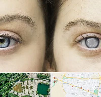 متخصص آب سیاه (گلوکوم) در وکیل آباد مشهد 