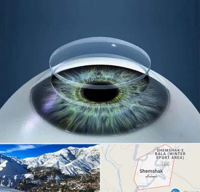 پیوند قرنیه در شمشک