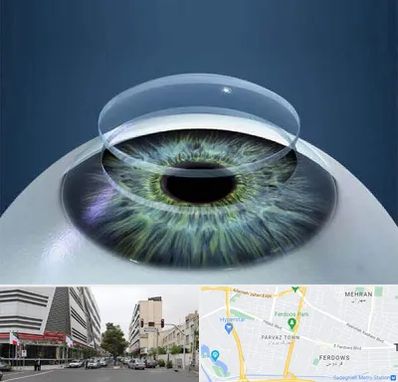 پیوند قرنیه در بلوار فردوس 