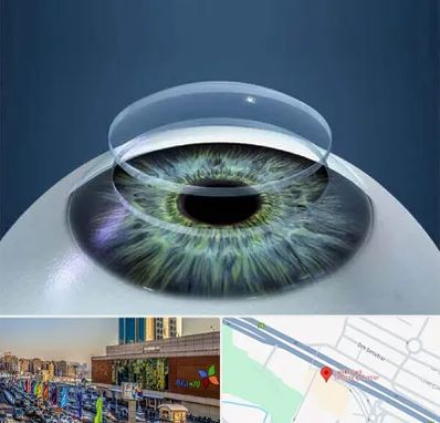 پیوند قرنیه در لاله پارک تبریز