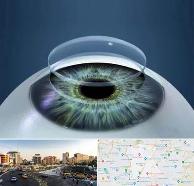 پیوند قرنیه در منطقه 7 تهران 