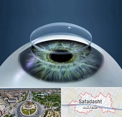 پیوند قرنیه در صفادشت