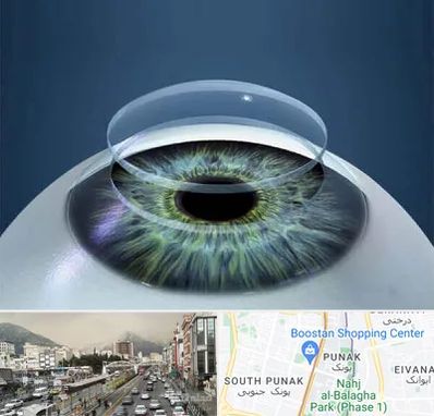 پیوند قرنیه در پونک 