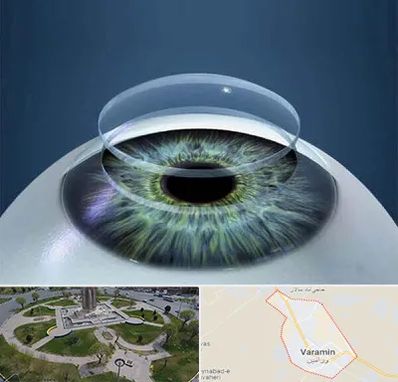 پیوند قرنیه در ورامین