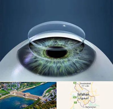 پیوند قرنیه در اصفهان