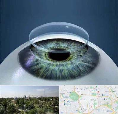 پیوند قرنیه در منطقه 16 تهران 