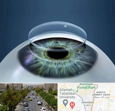 پیوند قرنیه در شهران 