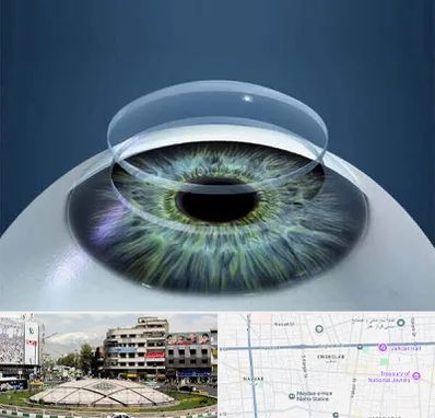 پیوند قرنیه در مرکز تهران