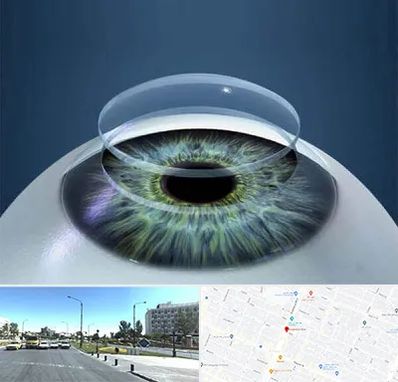 پیوند قرنیه در بلوار کلاهدوز مشهد 