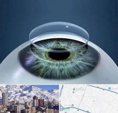 پیوند قرنیه در ازگل