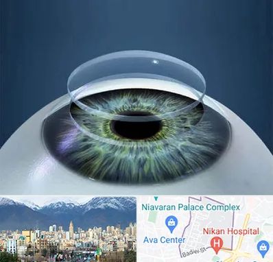 پیوند قرنیه در آجودانیه 