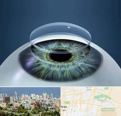 پیوند قرنیه در شرق تهران 