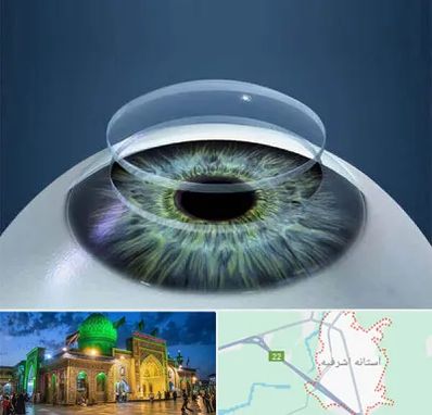 پیوند قرنیه در آستانه اشرفیه