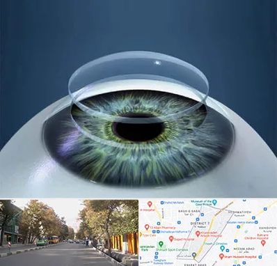 پیوند قرنیه در شریعتی 