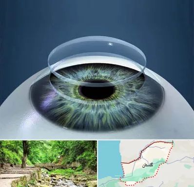 پیوند قرنیه در گلستان