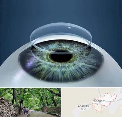 پیوند قرنیه در شاندیز مشهد