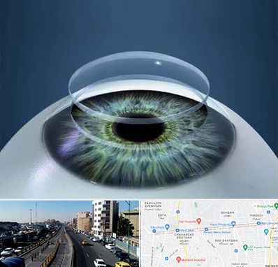 پیوند قرنیه در پیروزی 